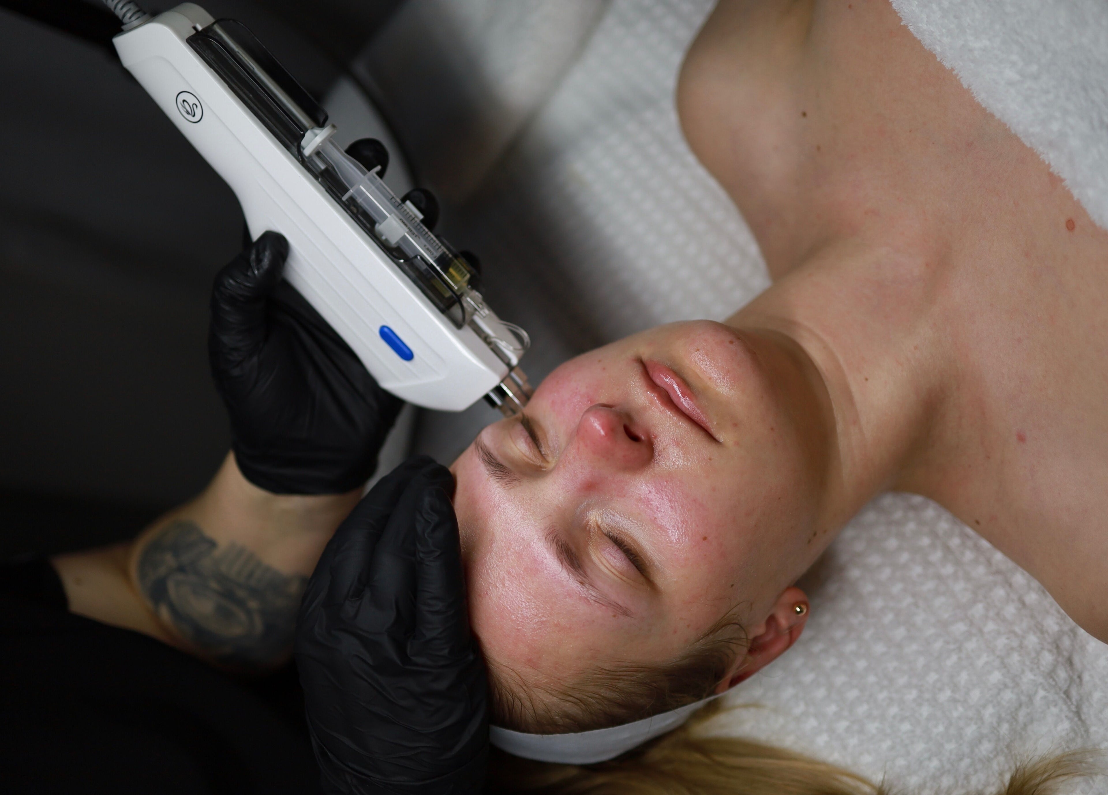Facial treatment at Skin Spa Embassy, Northampton, England, GB enhancing skin glow.