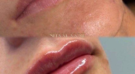 Shani-Anne Aesthetics and Medical Tattooing image 3