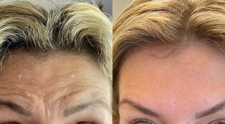 Glow Aesthetics at Regis Hair Salon Kingston image 3