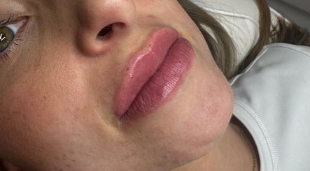 Close-up of enhanced lips at SCULPT. Aesthetics, Hook, Wales, GB, showcasing expert cosmetic results.