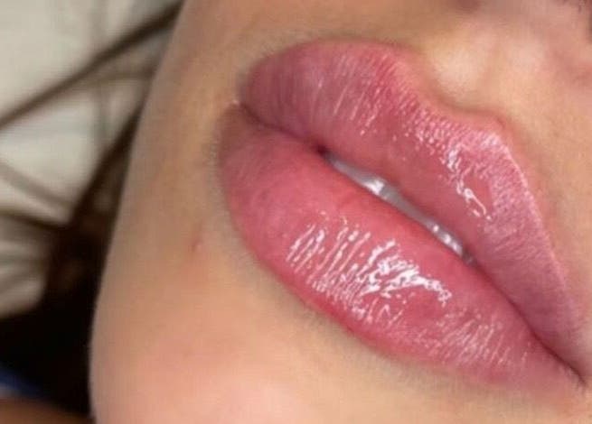 Close-up of glossy lips at YOU Aesthetics by Sofia, Caterham, England, GB.