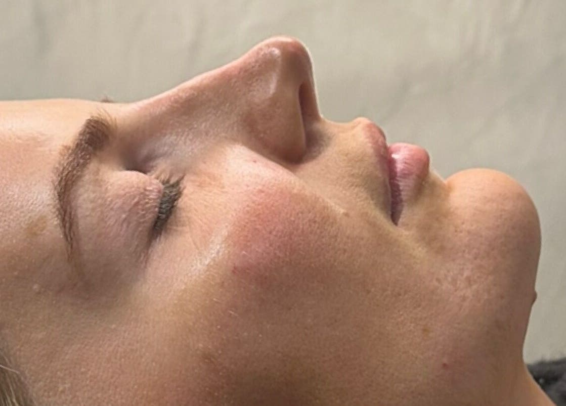 Relaxed client at YOU Aesthetics by Sofia, Caterham, England, GB enjoying a soothing beauty treatment session.