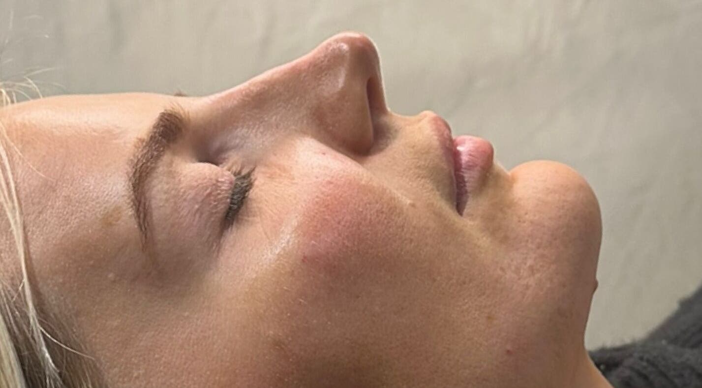 Relaxed client at YOU Aesthetics by Sofia, Caterham, England, GB enjoying a soothing beauty treatment session.