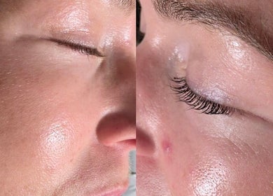 Close-up of glowing skin after treatment at Beauty Home Spa, Saskatoon, Saskatchewan, CA
