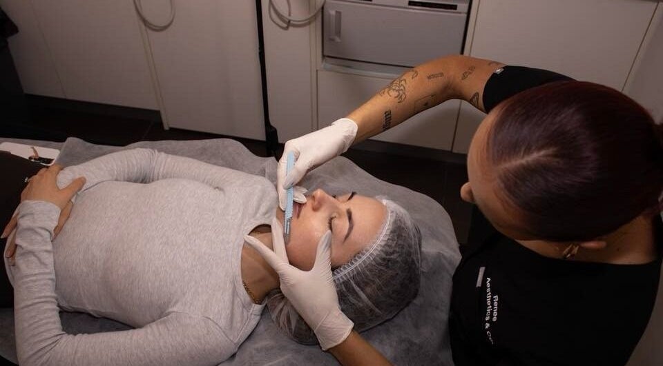 Professional dermaplaning at Aesthetics and Co., Melbourne, Victoria, AU, enhancing skincare.