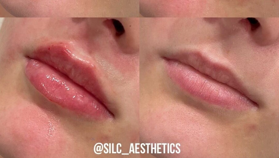 Silc Aesthetics  – obraz 1
