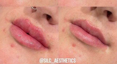 Silc Aesthetics  – obraz 2