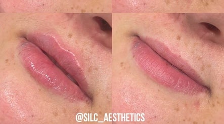 Silc Aesthetics  – obraz 3