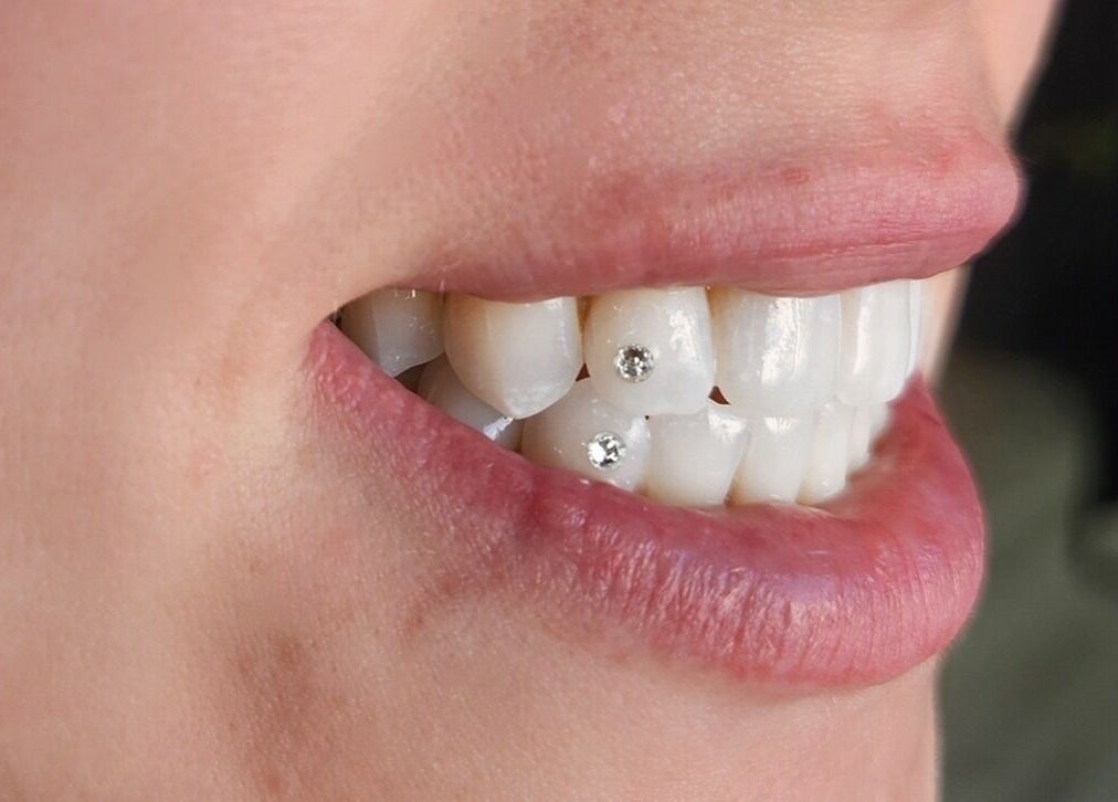 Close-up of a smile with tooth gems at Tash's Tanning, Beldon, Western Australia, AU.