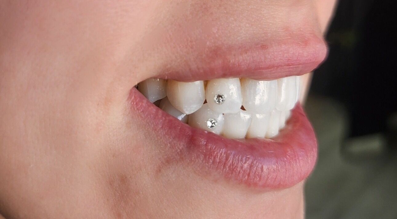Close-up of a smile with tooth gems at Tash's Tanning, Beldon, Western Australia, AU.