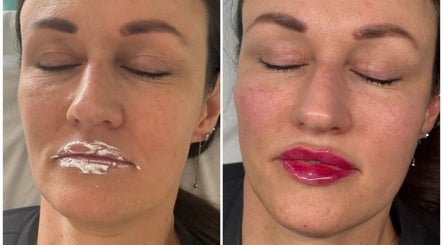 Face Me Aesthetics (Wokingham location Saturday only), bilde 3