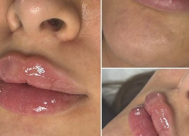 Close-up of lips after treatment at Face Me Aesthetics, Arborfield Green, England, GB highlighting glossy finish.
