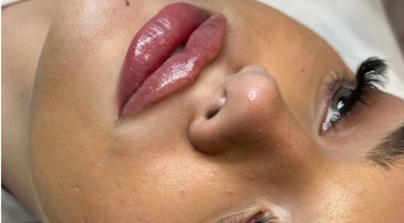 Close-up of client's lips at Face Me Aesthetics, Arborfield Green, England for a beauty enhancement.