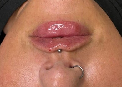 Close-up of glossy lips with piercing at Face Me Aesthetics, Arborfield Green, England, GB.
