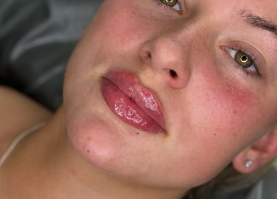 Close-up of glossy lips at Beth Holden Aesthetics, Bamber Bridge, England, GB.
