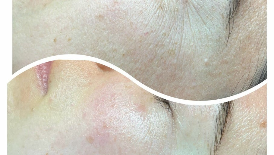 HealthyGlow-Teni image 1