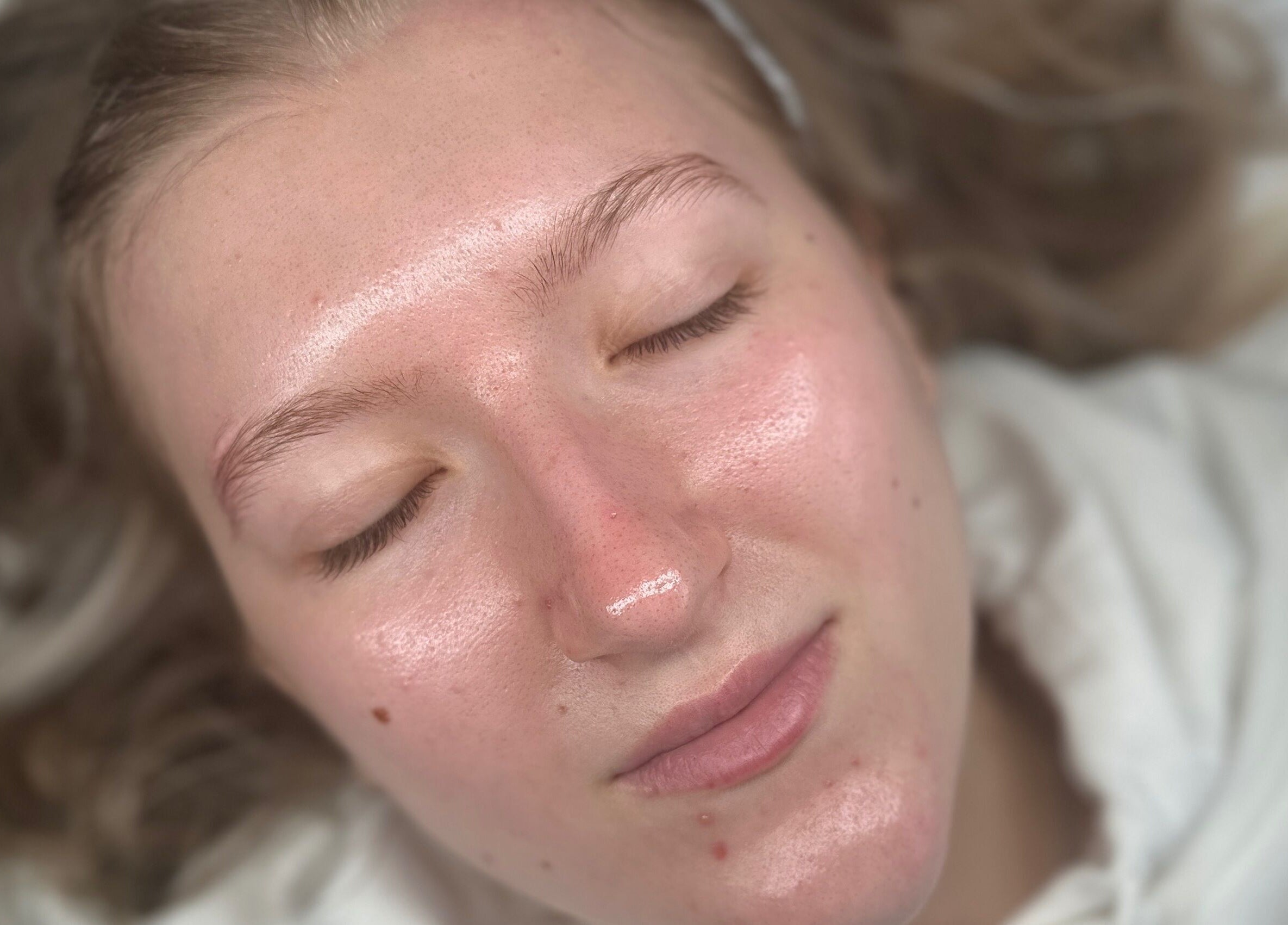 Close-up of glowing facial skin treated at GH Beauty in Peterborough, England, GB.