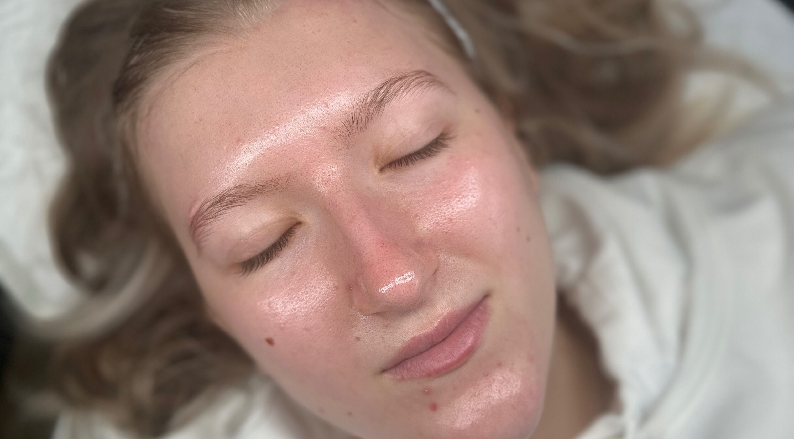 Close-up of glowing facial skin treated at GH Beauty in Peterborough, England, GB.