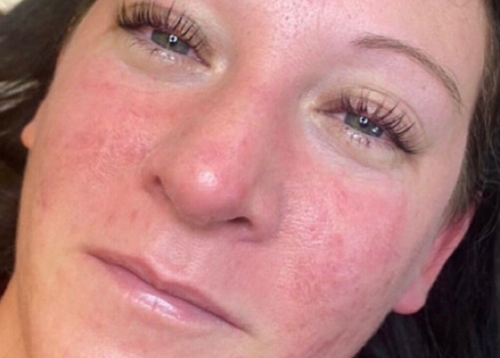 Close-up of a serene face with glowing skin at GH Beauty, Peterborough, England, GB.