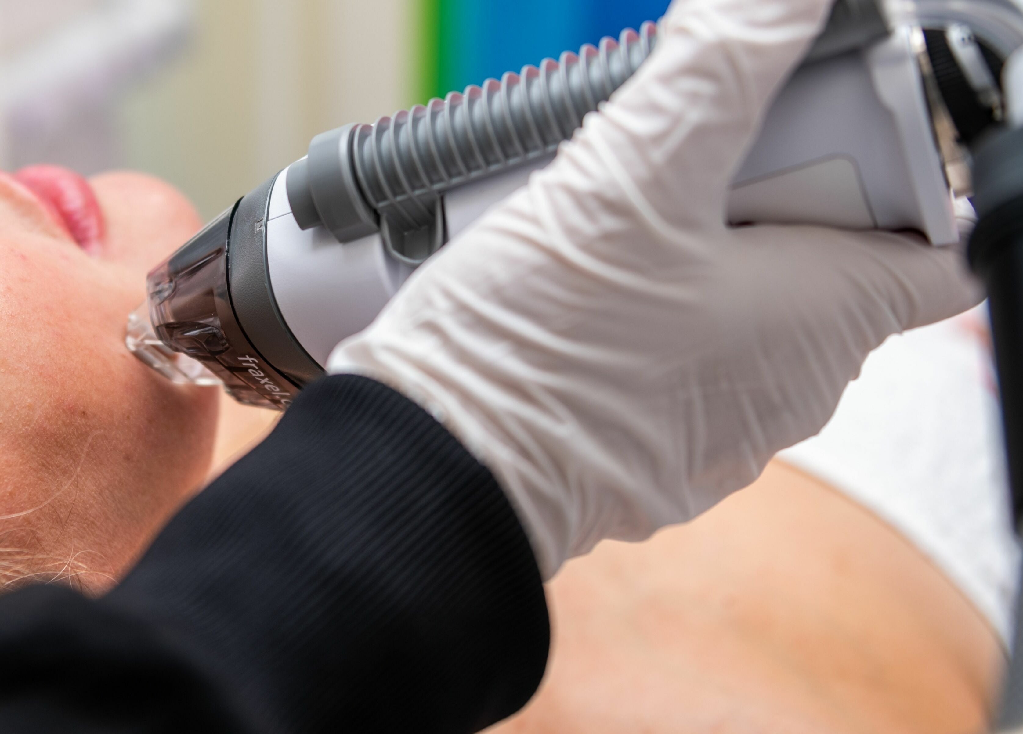 Facial laser treatment at Diamond Skin - Doctor Led Aesthetic and Laser Clinic, Wembley, England, GB.