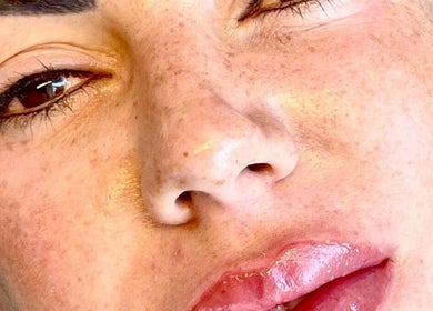 Close-up of radiant skin treatment at S’thetics in Cape Town, Western Cape, ZA.