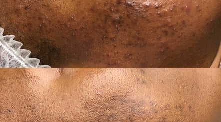Skin NV image 3