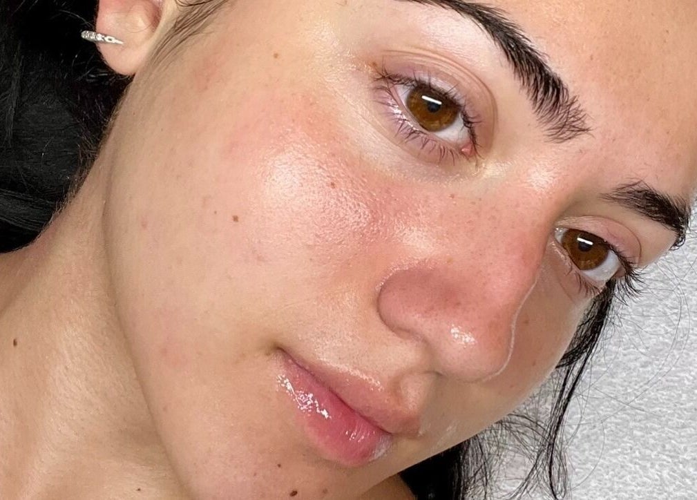 Close-up of a fresh, glowing face after treatment at Lashesxbeautybar in Vaughan, Ontario, CA.