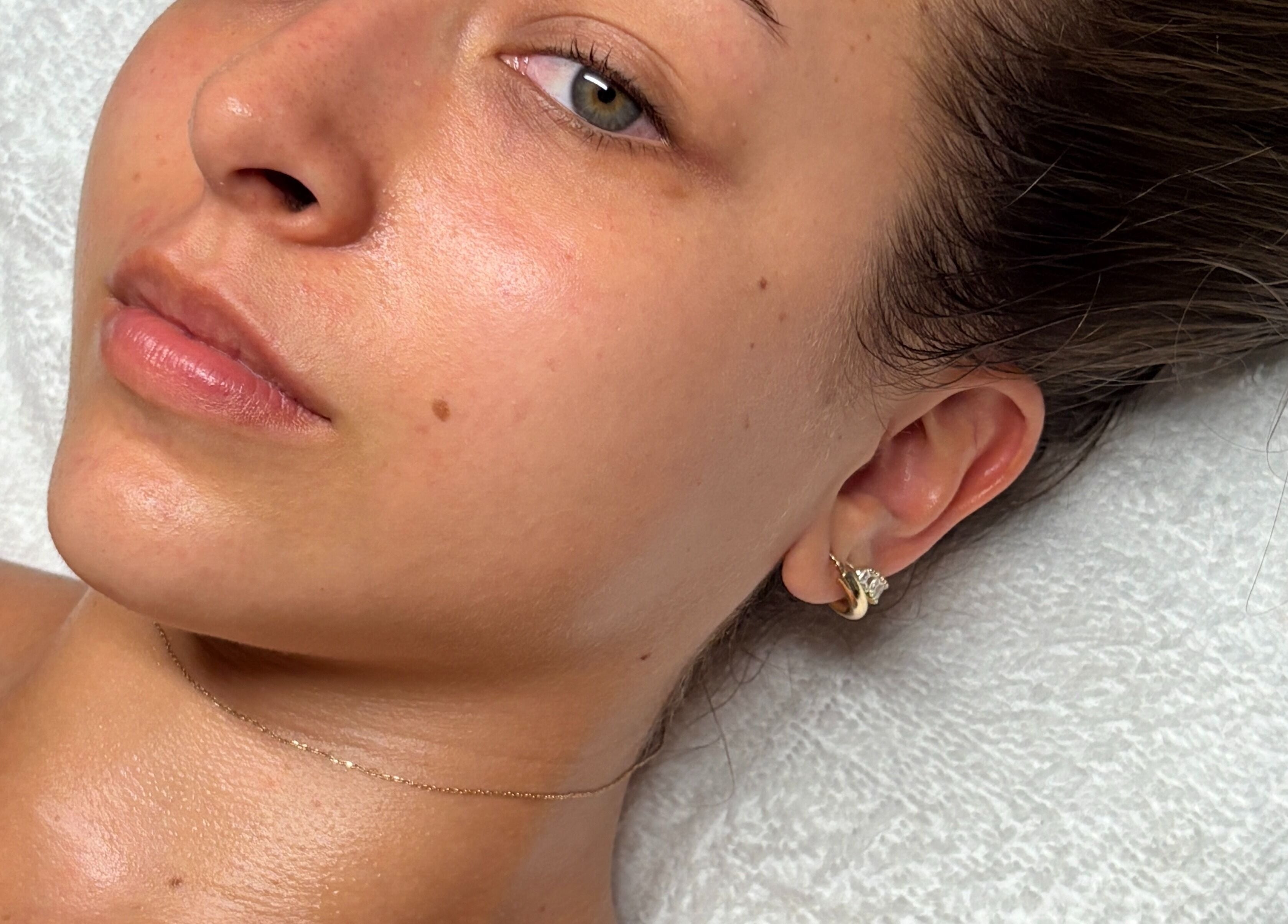 Close-up of a radiant facial at Lashesxbeautybar, Vaughan, Ontario, CA, displaying smooth, glowing skin.