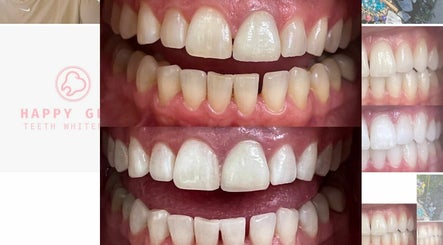 Happy Glow Teeth Whitening  – obraz 2