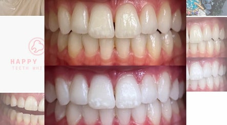 Happy Glow Teeth Whitening , bilde 3