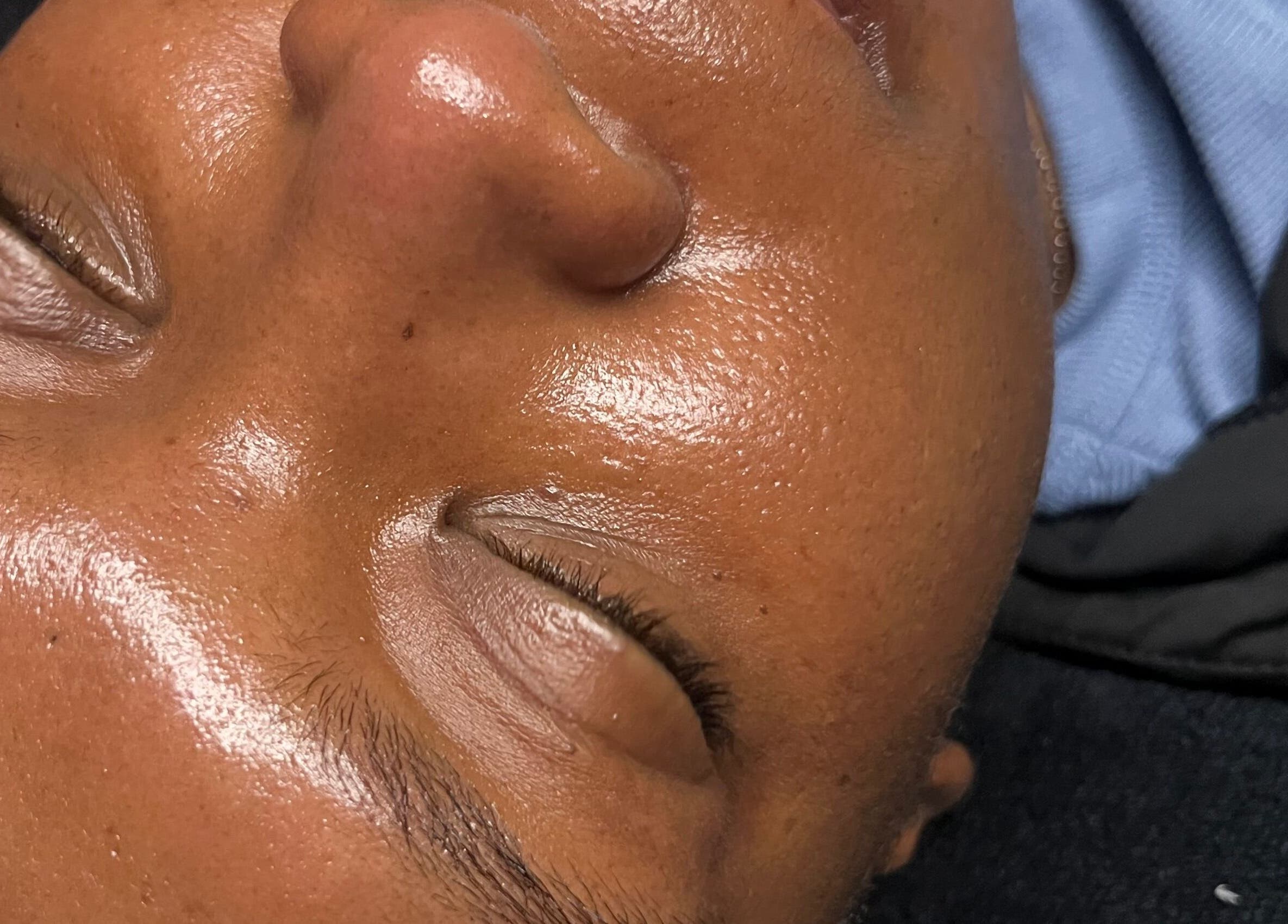 Close-up of glowing skin during facial at Studio Nessy Truth Montréal, Montréal, Québec, CA.