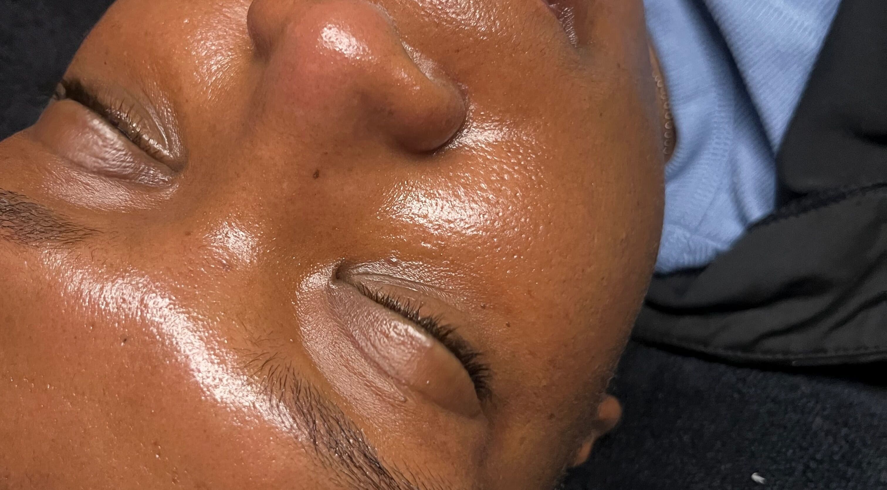 Close-up of glowing skin during facial at Studio Nessy Truth Montréal, Montréal, Québec, CA.