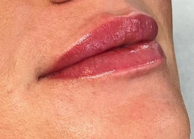 Glossy, well-defined lips enhanced at Discover Beauty London, Albany Park, Sidcup, located in Bexley, England, GB.