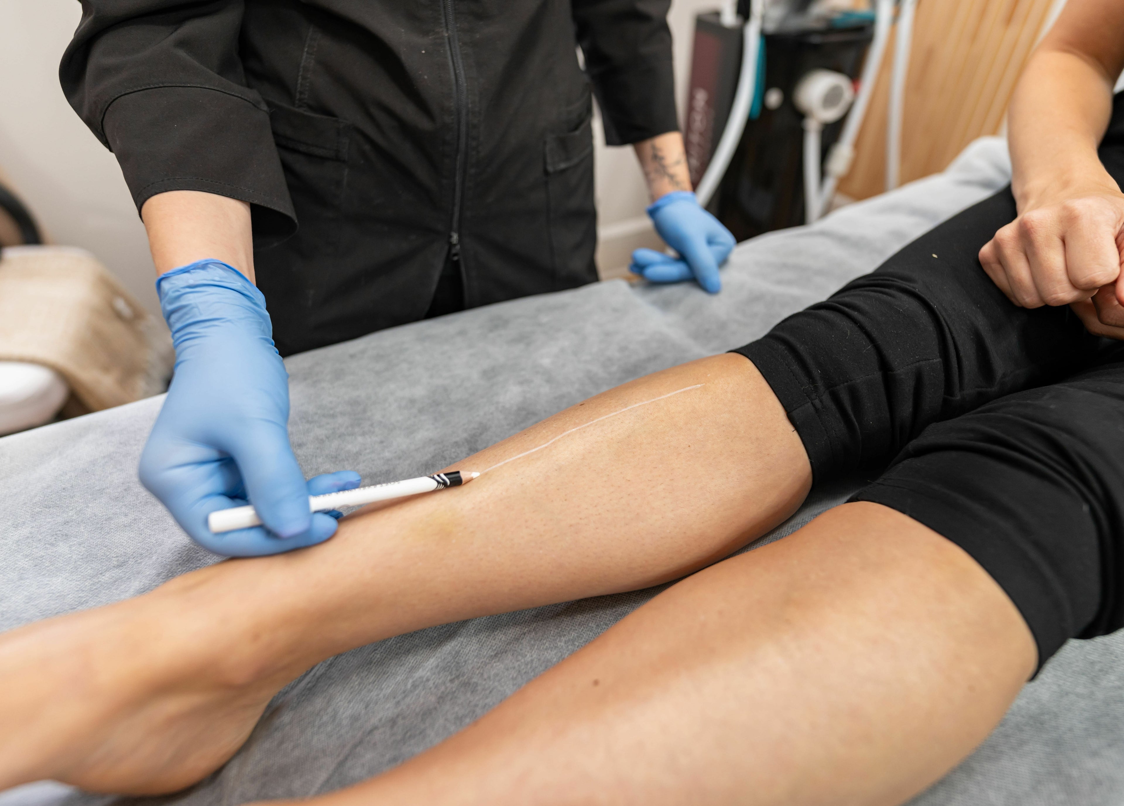 Traitement esthétique de jambes à JN Esthétique, Terrebonne, Québec, CA, avec précision professionnelle.