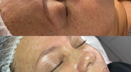 Imagen 2 de Hidrapiel Esthetic