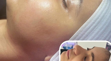 Imagen 3 de Hidrapiel Esthetic