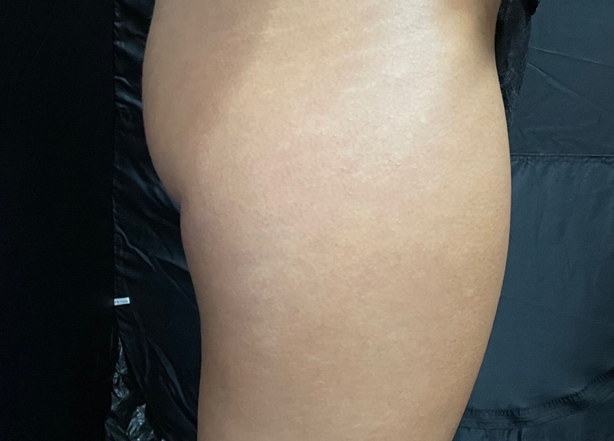 Close-up of smooth skin at Cassandra Jade’s Collective, Alberton, Gauteng, ZA.