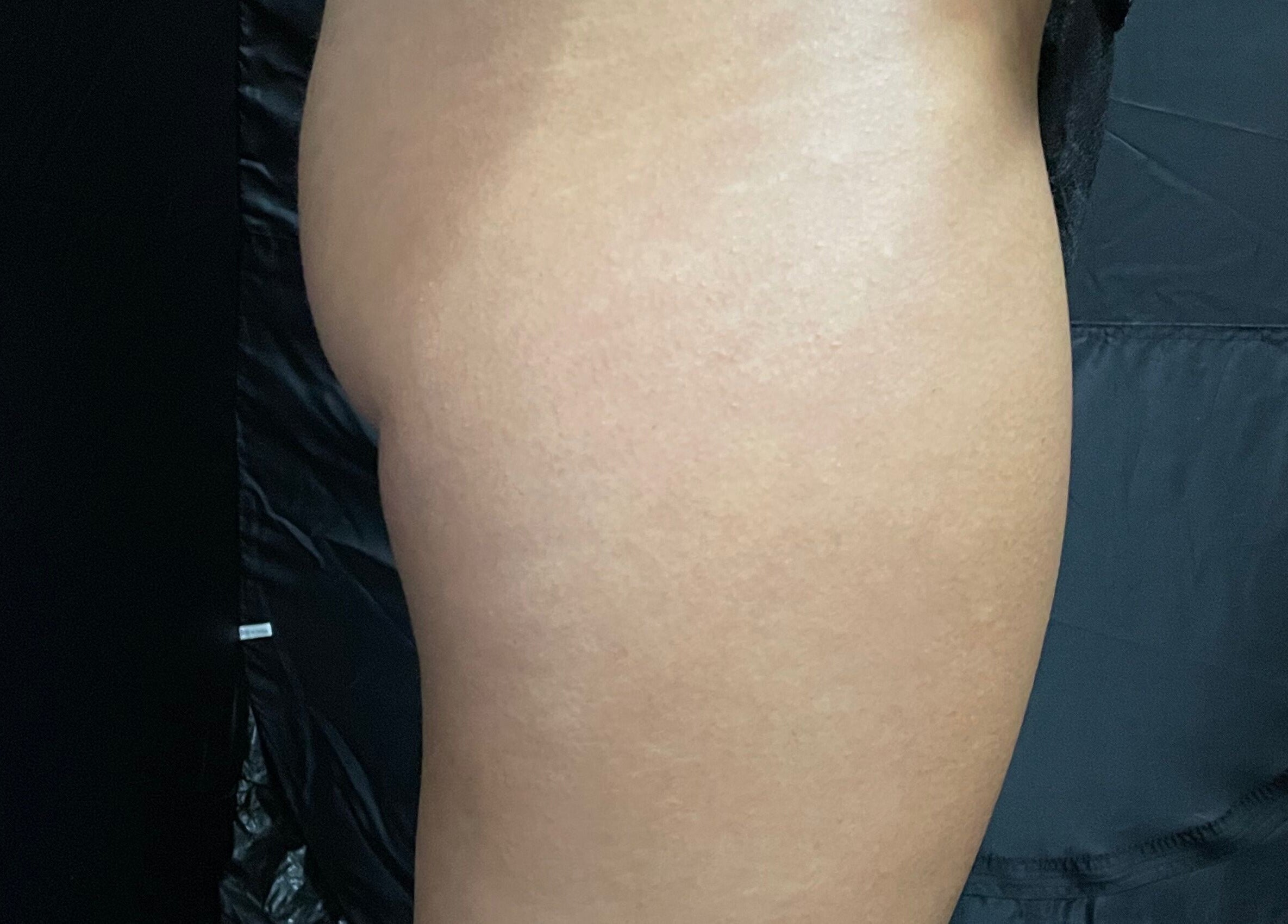 Close-up of smooth skin at Cassandra Jade’s Collective, Alberton, Gauteng, ZA.