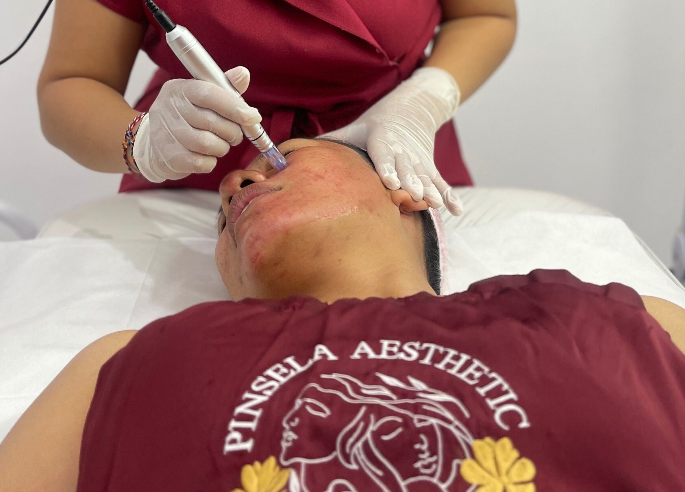 Professional skin treatment at Pinsela Aesthetic, Bali, Bali, ID showing a specialist performing a facial procedure.