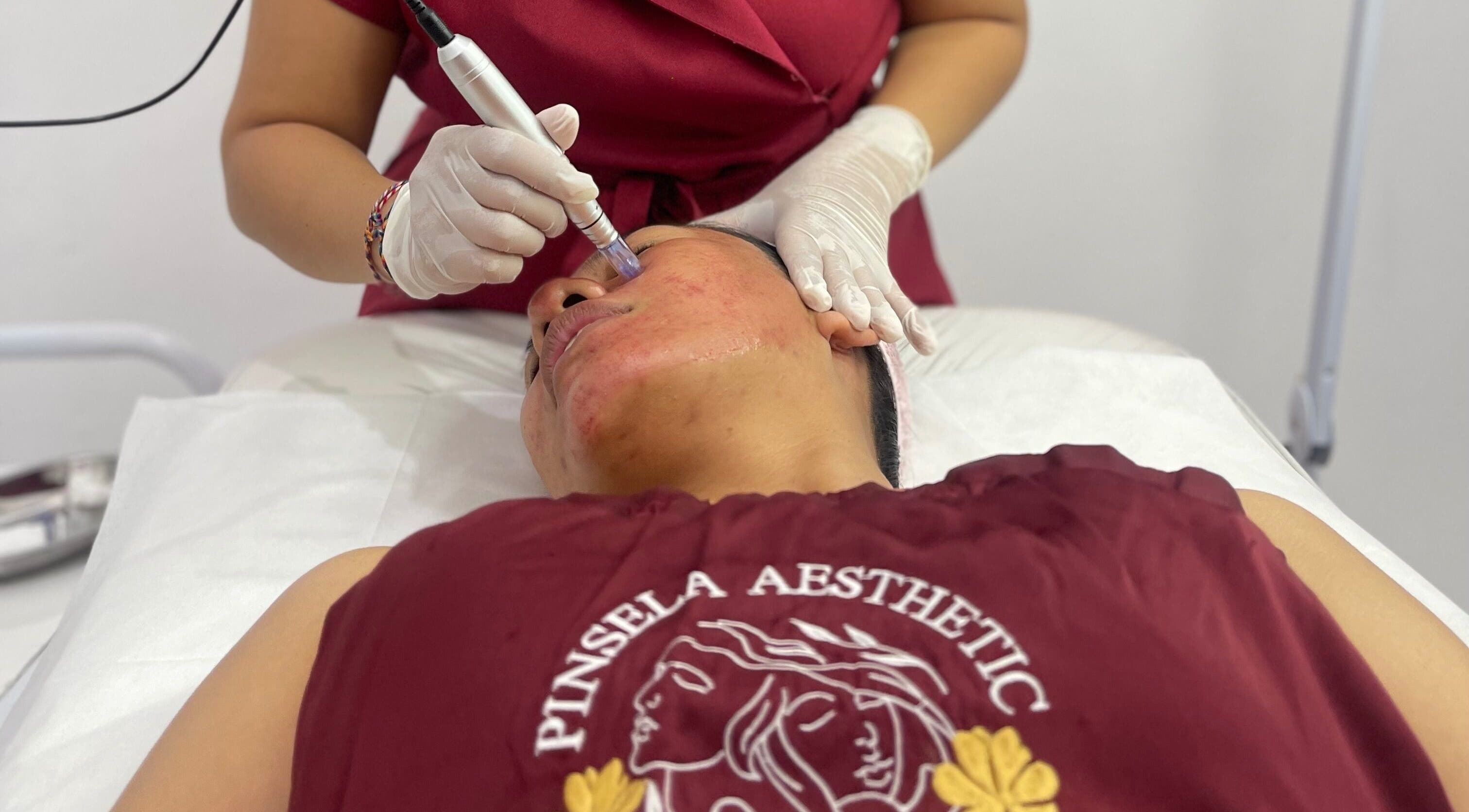 Professional skin treatment at Pinsela Aesthetic, Bali, Bali, ID showing a specialist performing a facial procedure.