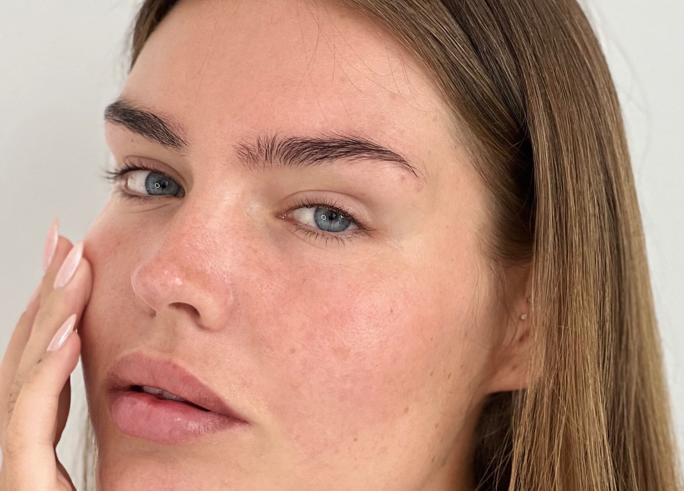 Close-up of radiant skin promoted by Pinsela Aesthetic, Bali, Bali, ID for natural beauty care.