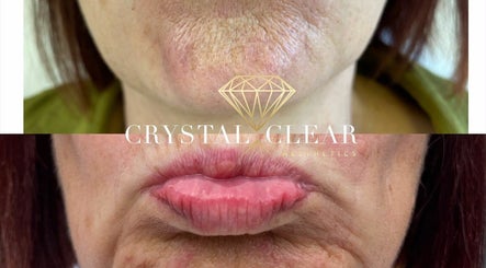 Crystal Clear Aesthetics, bild 2