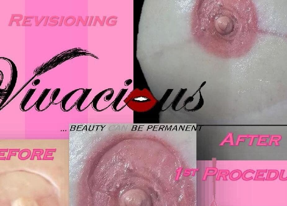Vivacious Permanent Beauty showcases nipple correction in Pretoria, Gauteng, ZA; before and after views.