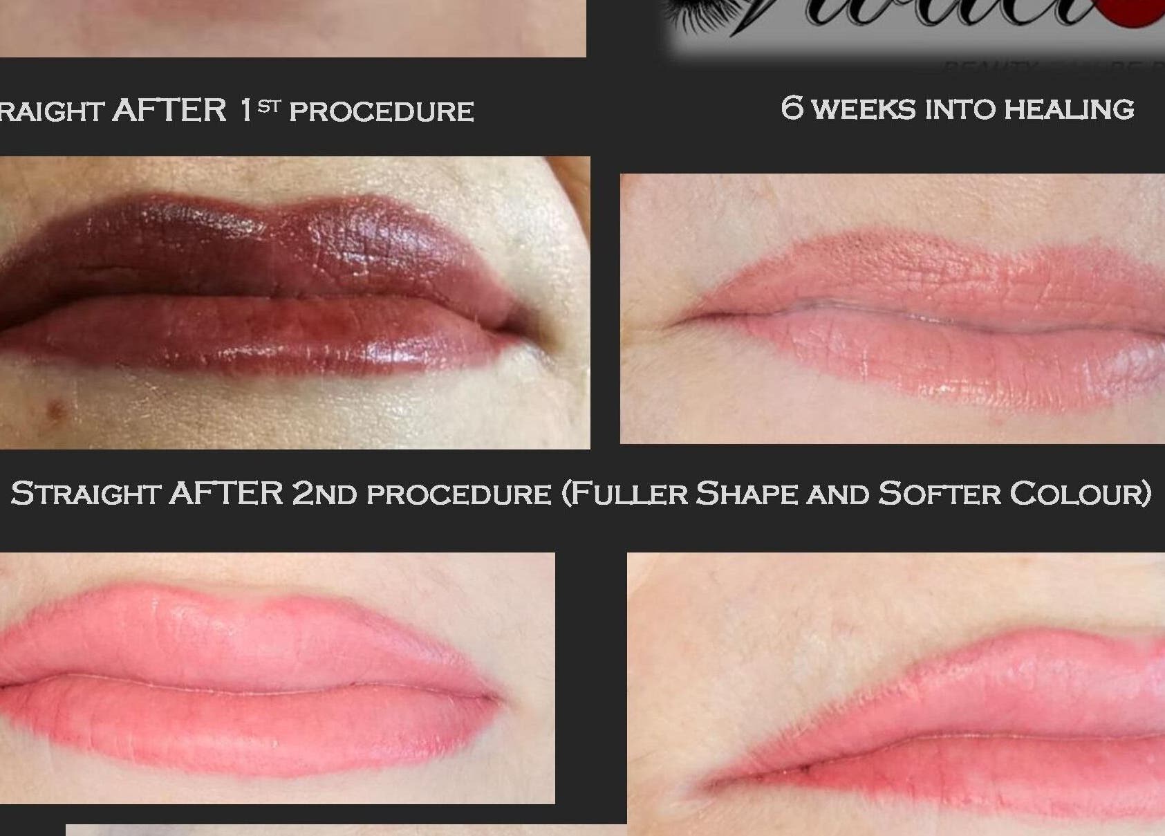 Lip transformation progress at Vivacious Permanent Beauty in Pretoria, Gauteng, ZA, displaying different stages.