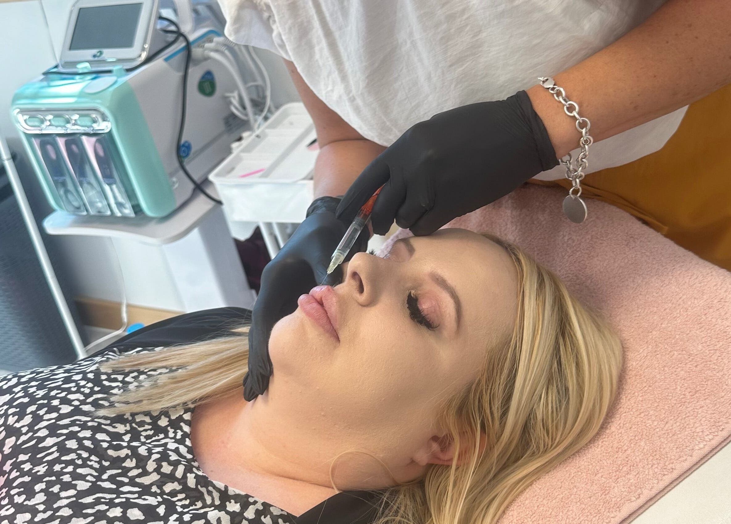 Lip enhancement procedure at Barbara Sue Aesthetics Ltd, Felixstowe, England, GB. Aesthetician administering treatment.