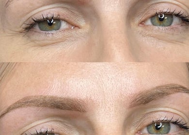 Before and after brow transformation at Redefined Brows by Sarah - May in Lurgan, Northern Ireland, GB.