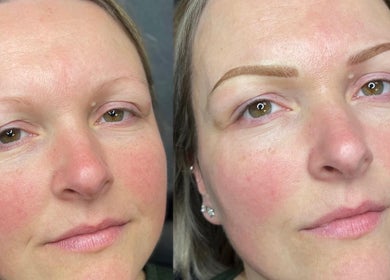 Before and after eyebrow transformation at Redefined Brows by Sarah - May in Lurgan, Northern Ireland, GB.