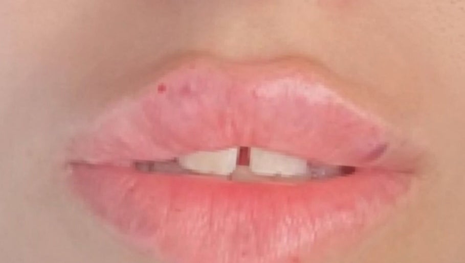 NS BeautyAesthetics image 1