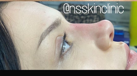 NS BeautyAesthetics image 3
