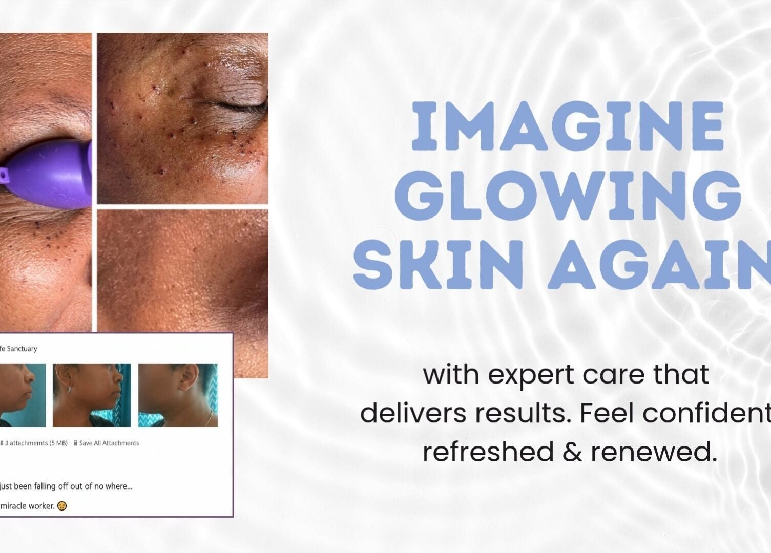 Rejuvenated skin treatment results at Spa Life Sanctuary in Philadelphia, Pennsylvania, US.